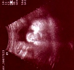 A baby; Actual size=180 pixels wide